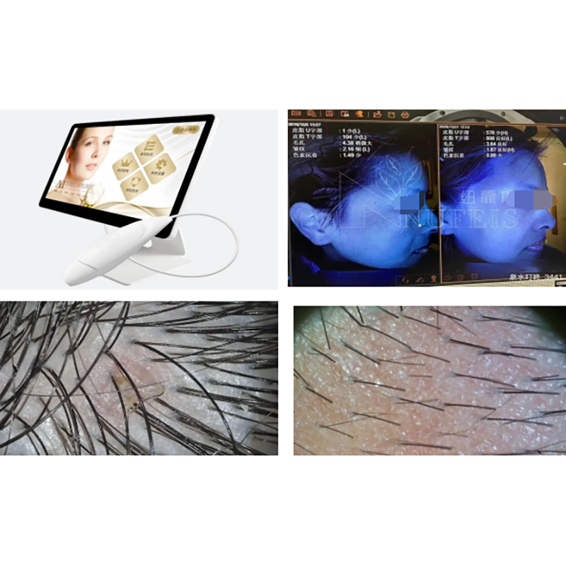 Skin Scalp Hair Test Solution